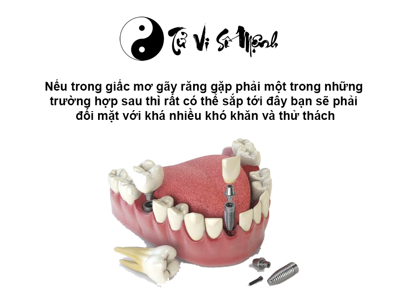 Giải mã giấc mơ gãy răng và con số may mắn