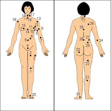 Xem bói nốt ruồi trên cơ thể